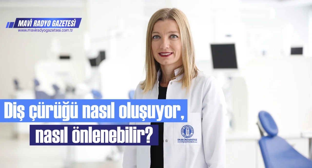Diş çürüğü nasıl oluşuyor, nasıl önlenebilir? 
