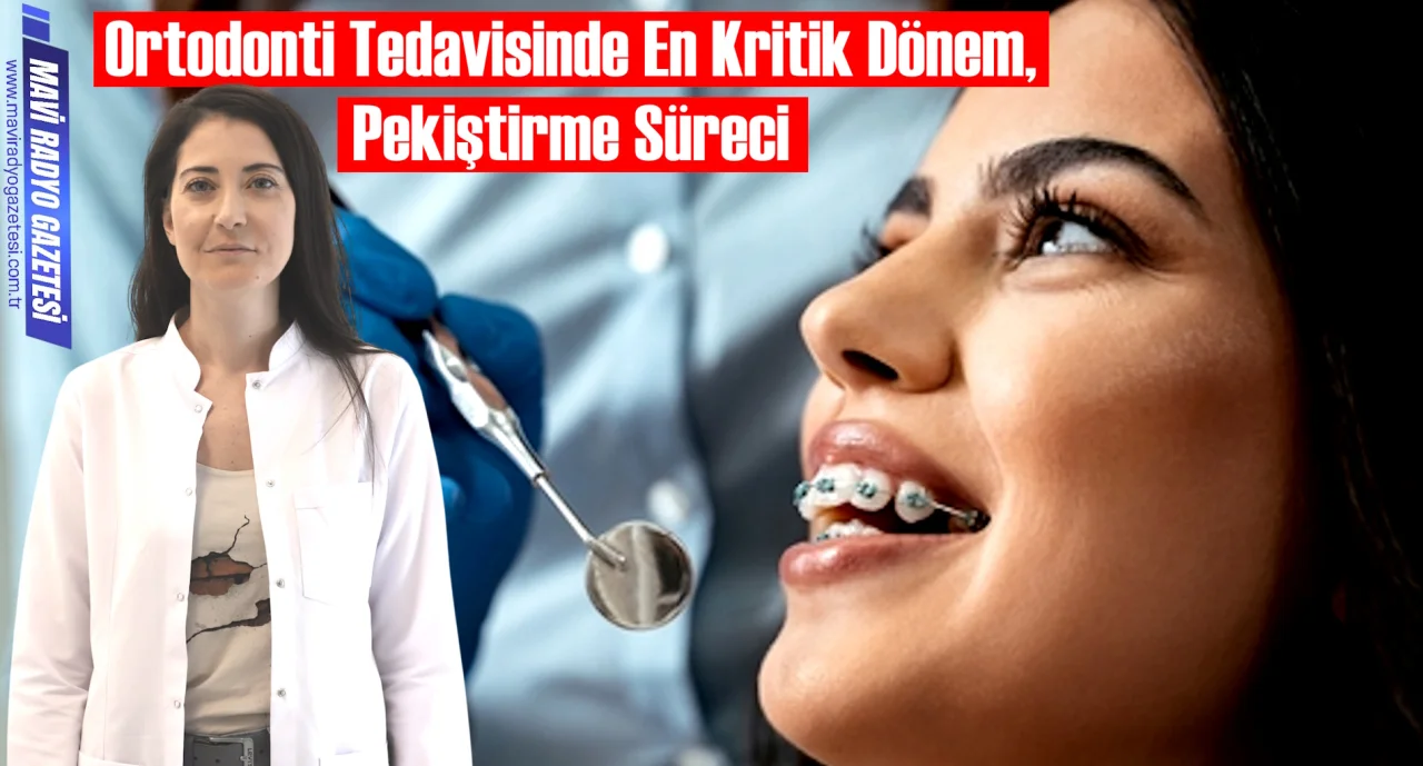 Ortodonti Tedavisinde En Kritik Dönem, Pekiştirme Süreci 